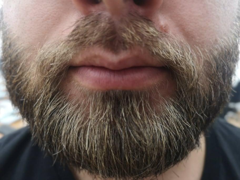 Ako nosite bradu, moguće da imate više bakterija nego pas