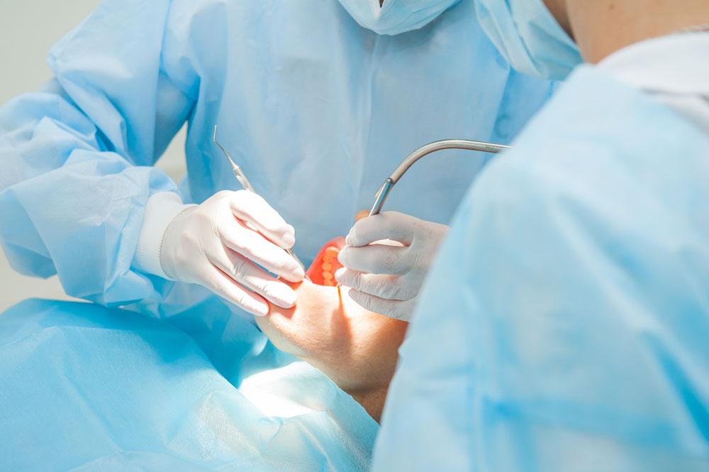 Operacijom zuba postiže se željeni rezultat