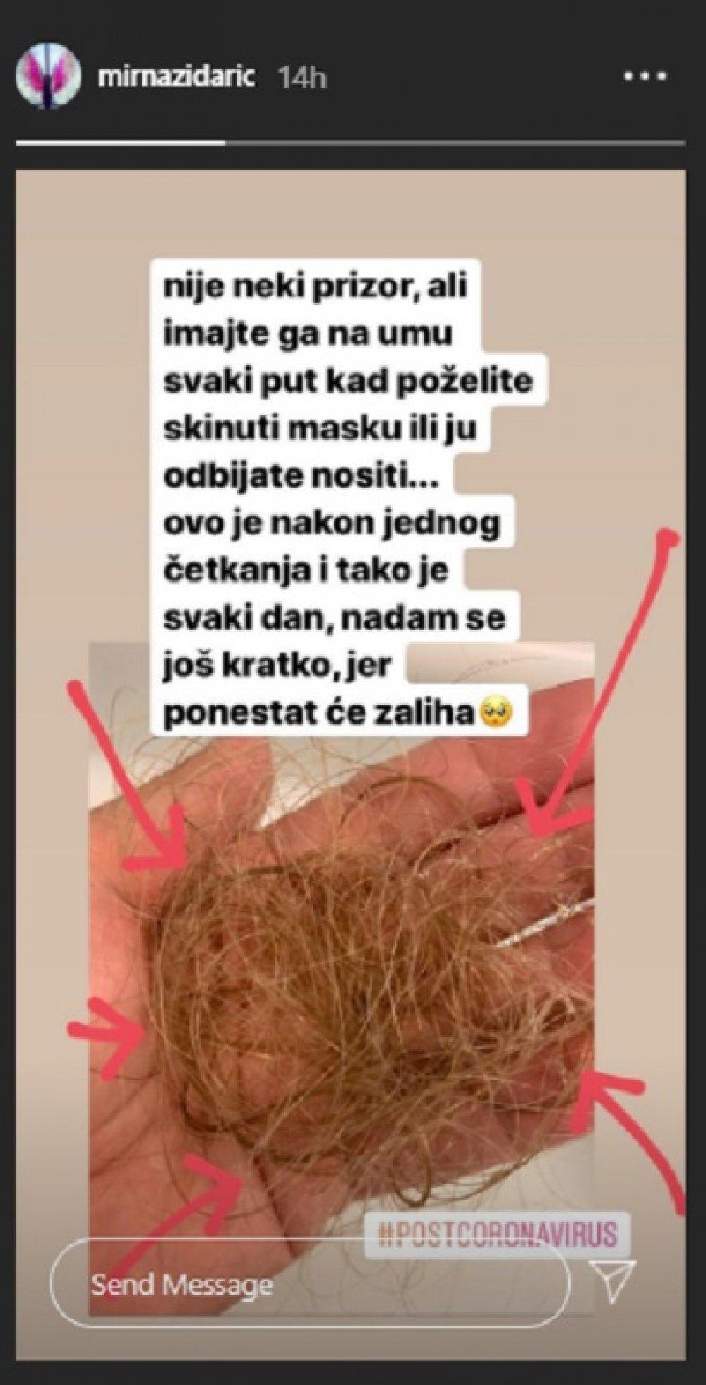 Voditeljica pokazuje posljedice koronavirusa - Avaz