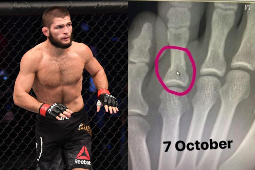 Nurmagomedov: Objavio rengenski snimak preloma - Avaz