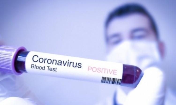 B&H registers 582 new cases of coronavirus, 63 persons died