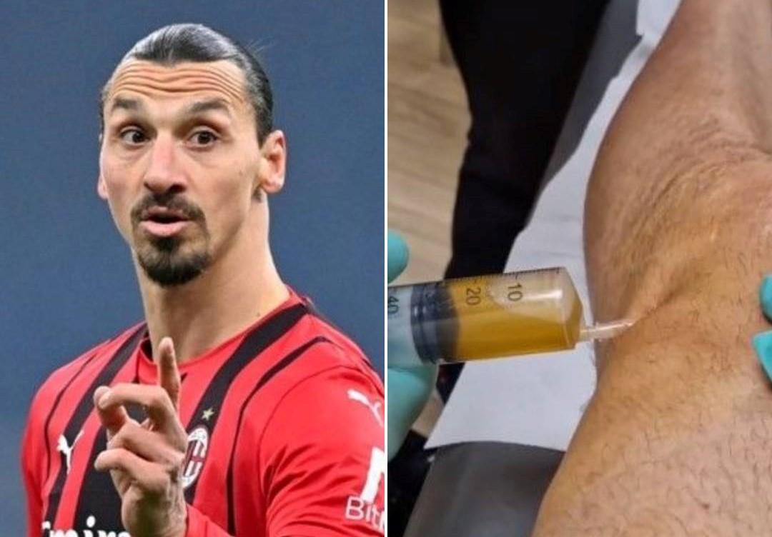 Zlatan je trpio bolove tokom sezone - Avaz