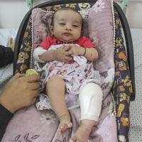 Beba Esma preko noći postala siroče: Jedina iz porodice preživjela izraelski napad u Gazi
