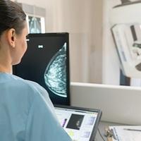 Mamografija: Evo koliko često je trebate raditi