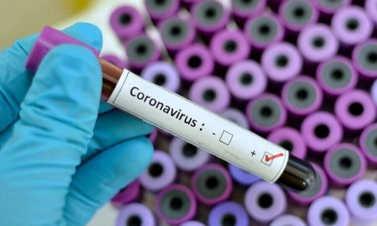 Za 50 eura prodaju negativni test na koronavirus